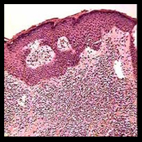 Pathology Slides